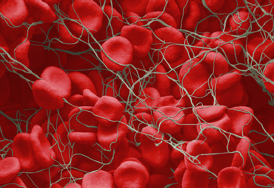 Red blood cells forming clot, SEM