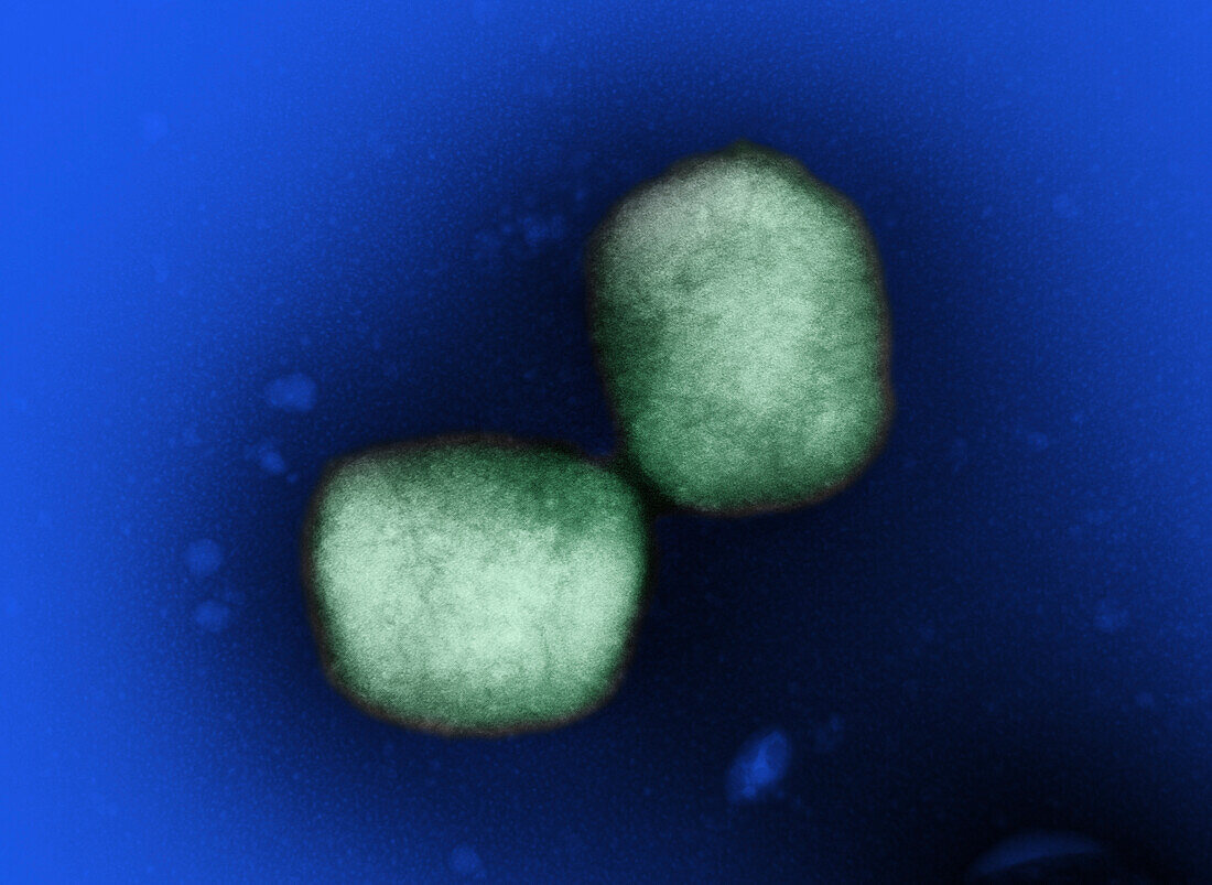 Mpox virus particles, TEM