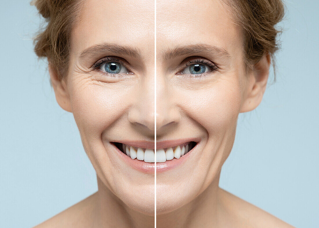 Anti-aging treatment