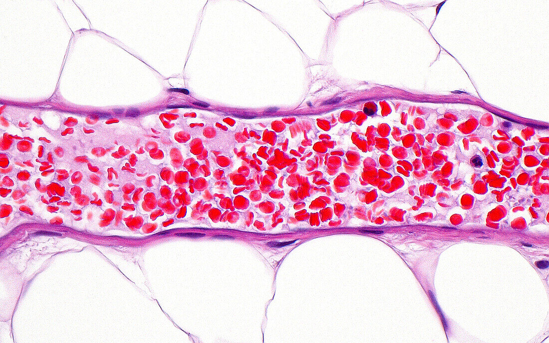 Blood vessel, light micrograph