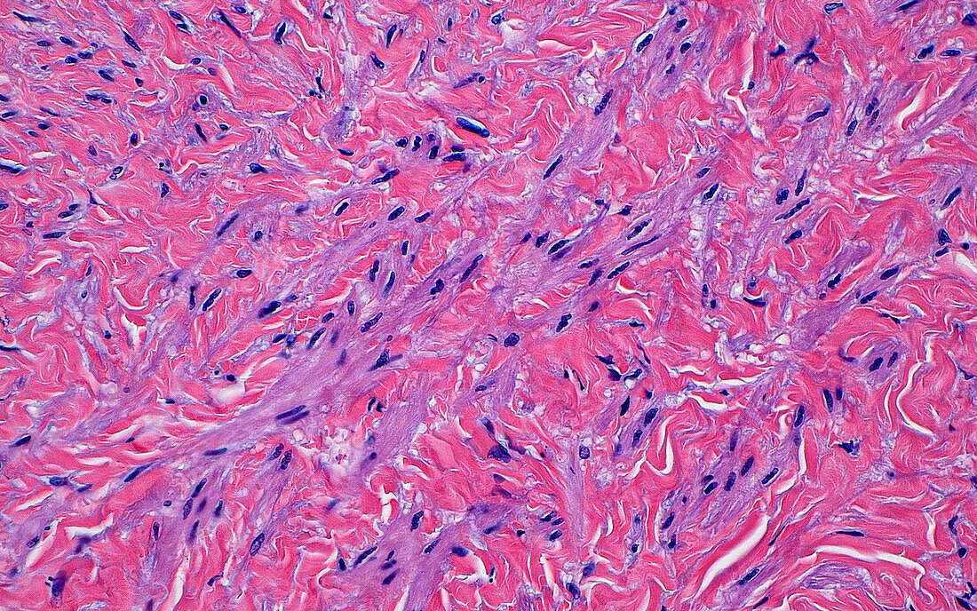 Liver capsule, light micrograph