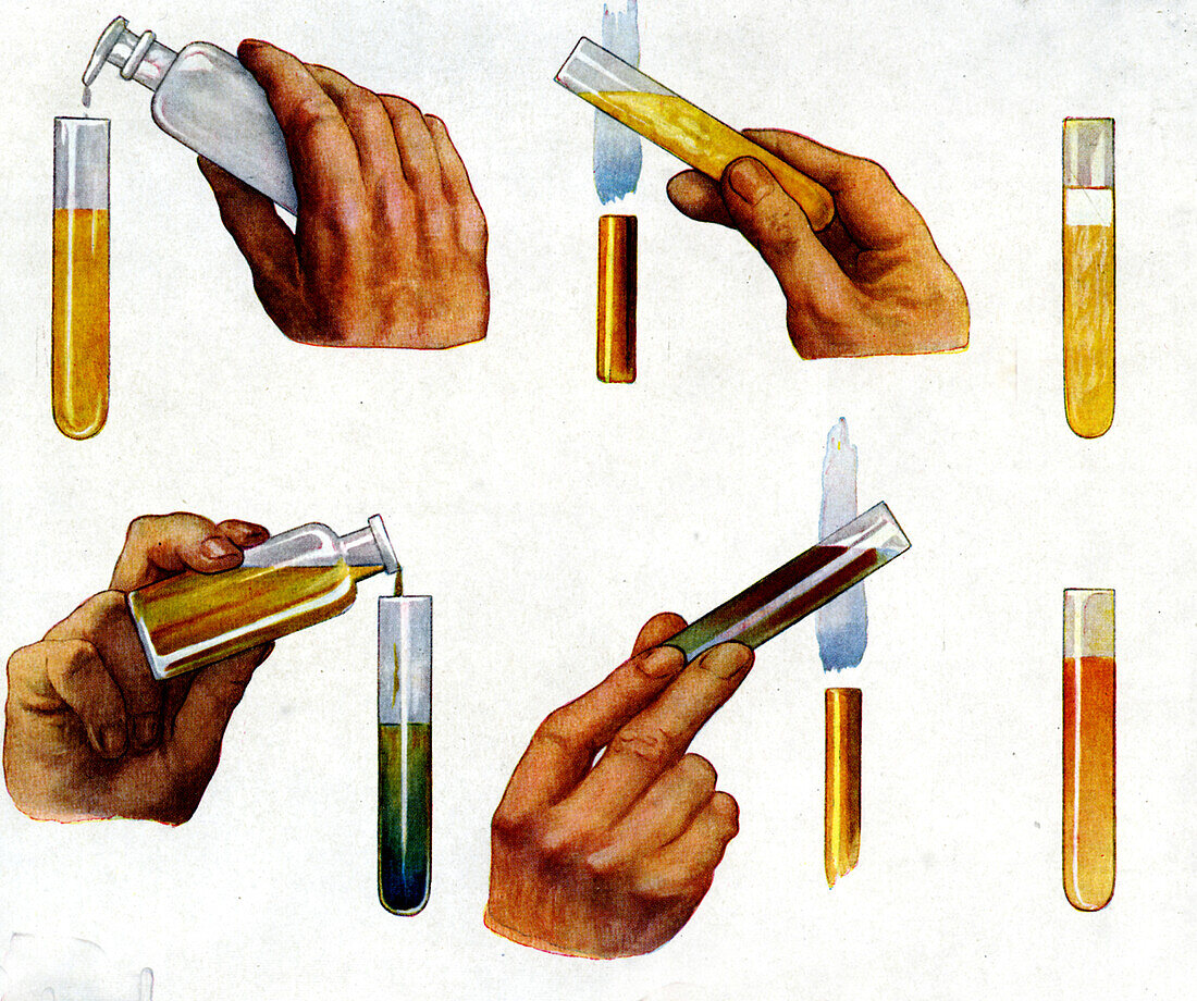 Urinalysis, illustration