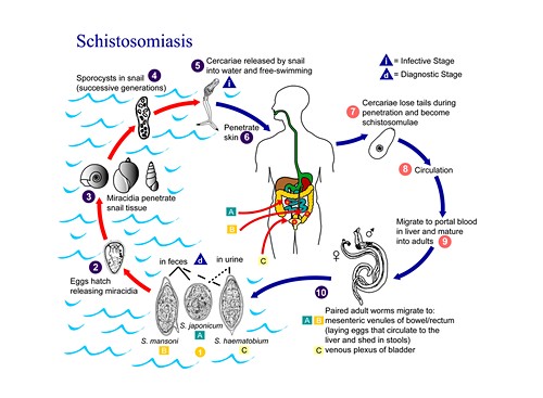 Bilharzia or schistosomiasis Bilder Science Photo Library