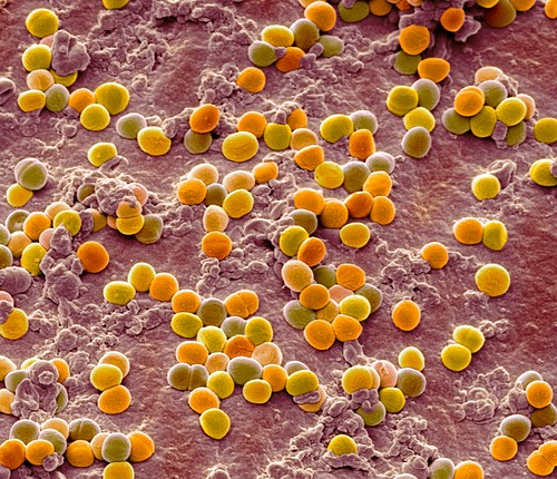 Staphylocoque doré Photos Science Photo Library