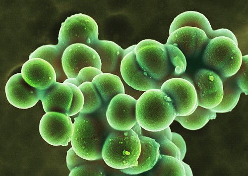 Staphylocoque doré Photos Science Photo Library