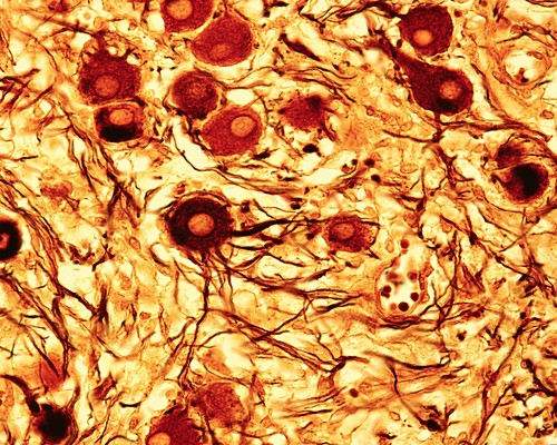 Ganglion Bilder Science Photo Library