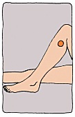 Illustration, Akupressur, Shiatsu, Ruhe-Punkt, Bein, Beruhigung