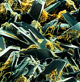 False-colour SEM of glucose crystals