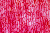 Light micrograph of onion epidermis