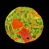 Chloroplasts in protoplast of tobacco