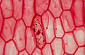 Onion skin showing cell during mitosis