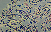 Anthrax bacteria