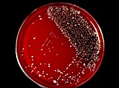 Petri dish culture of skin bacteria