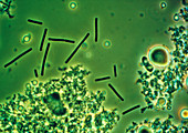 LM of Lactobacillus bulgaricus bacteria