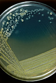 Bacterial colonies