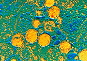 Coloured TEM of Chlamydia sp. bacteria