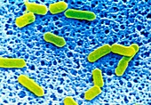 Coloured SEM of Listeria sp. bacteria