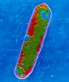 TEM of Clostridium tetani bacterium