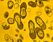 TEM of Bordetella pertussis bacterium