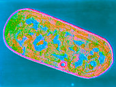 Clostridium perfringens bacterium