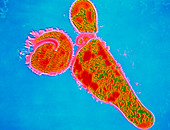 Bordetella pertussis bacterium