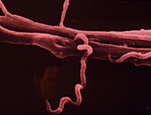 SEM of treponema pallidum bacteria