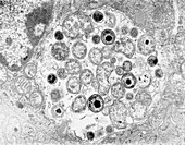 Chlamydia bacteria in a lung cell