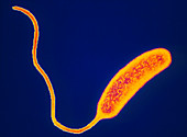 TEM of Vibrio cholerae bacterium