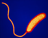F-col TEM of Vibrio cholerae bacterium