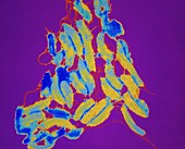 F/col TEM of Vibrio cholerae bacterium