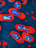 Coloured TEM of whooping cough bacteria