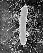 TEM of the bacteria,Proteus mirabilis