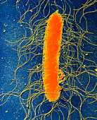 TEM of Proteus mirabilis bacterium