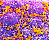 Helicobacter pylori bacteria in stomach