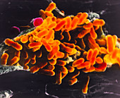 Rickettsia prowasekii bacteria