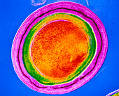 Clostridium tetani bacterial spore