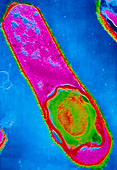 Clostridium perfringens bacterium with spore