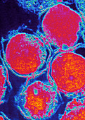 Chlamydia trachomatis bacteria