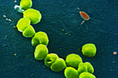 Neisseria gonorrhoeae bacteria