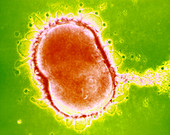 Neisseria meningitidis bacterium