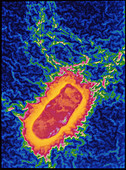 Salmonella bacteria