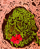 Anthrax bacteria in the lung