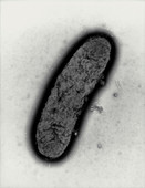 TEM of a Yersinia pestis bacterium