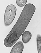 Clostridium difficile forming endospore