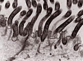 Treponema bacteria in duodenum