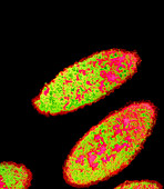 Bilophila wadsworthia bacteria
