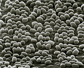Spores of Bacillus anthracis bacteria