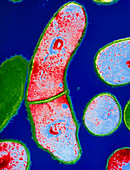 Corynebacterium diphtheriae bacteria