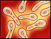 Coloured TEM of Corynebacterium bacteria