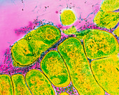 Actinobacillus bacteria with pili
